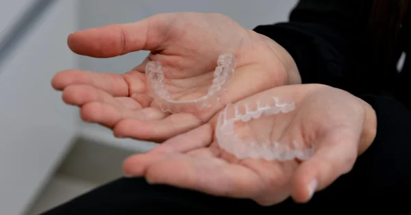 orthodontics-in-davanagere